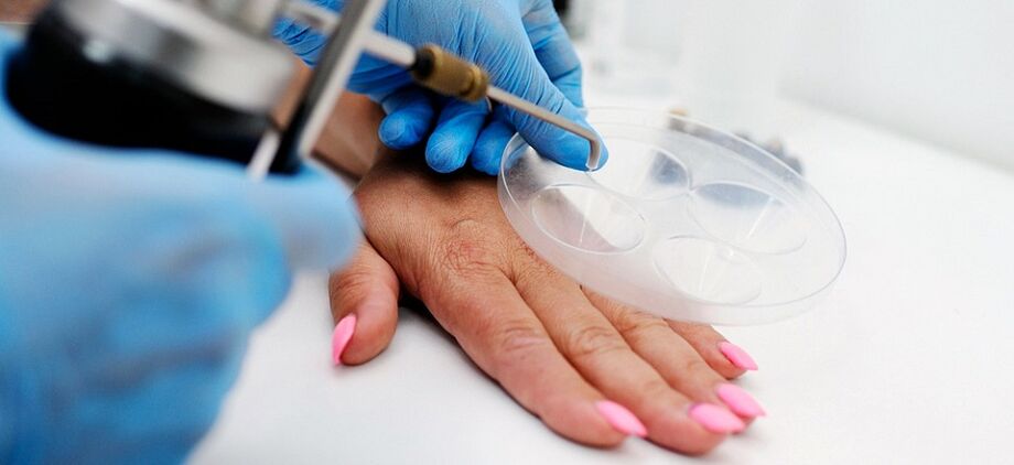 Professional hand wart removal